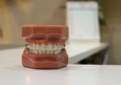 Cómo una Recepcionista Virtual IA para Consultorios Dentales Reduce el Abandono de Llamadas y Aumenta las Reservas