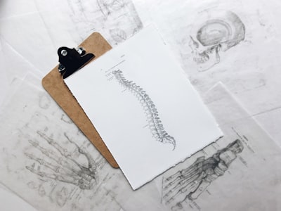 How Intrinsic Calibration Affects Vertebral X-Rays