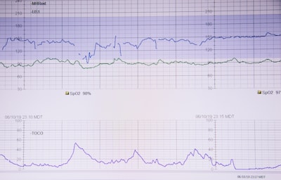 Optimización de rendimiento en Node.js: 60% más rápido con Caché y Optimización de Consultas