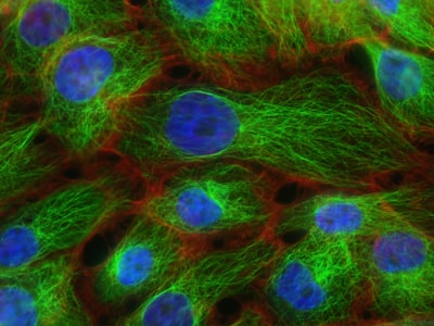 Generación molecular de alta fidelidad desde espectros de masas con difusión de grafos lineales