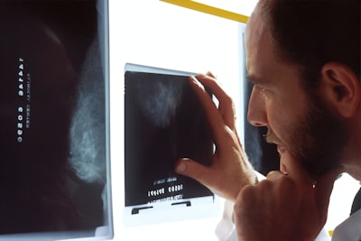 Interpretación de imágenes de resonancia magnética para detectar cáncer de próstata