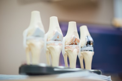 Aprendizaje profundo y predicción de dolor en osteoartritis