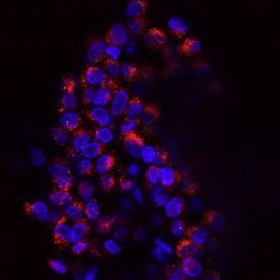 Delivering Antibody Conjugates for Axon Regeneration in Repair