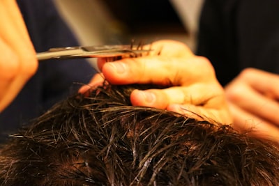 Trasplante capilar económico: restauración capilar asequible y efectiva