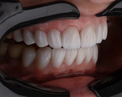 Reconstrucción 3D dental de bajo costo con IA