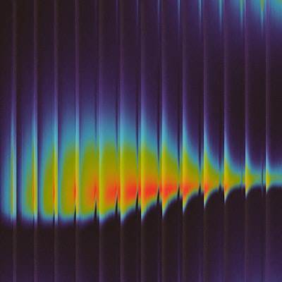 Optimizado Gradiente para Reducción de Artifactos en MRI a 3 T