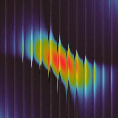 Control of Quantum Dot Qubit Phase Ensemble via Adaptive Stochastic Resonance