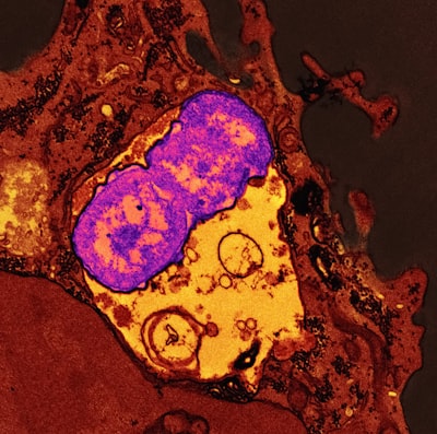 Detecting Cancer Metastasis in Gigapixel Pathology Images