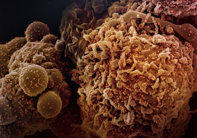 Diseñando un Sistema de IA Explicativo para el Cáncer Personalizado