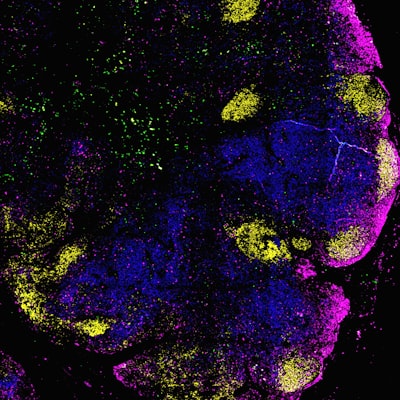 Estimación neuronal de parámetros del terreno con datos de sondeo radar