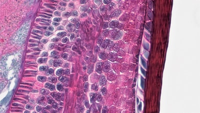 Fusión de capas adaptativas de clase y poda de doble etapa para modelos de lenguaje grandes multimodales