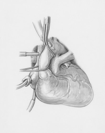 Cómo la IA sintetiza guías coronarias para PCI robótica