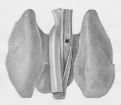 Detección pulmonar guiada por lenguaje con razonamiento gráfico