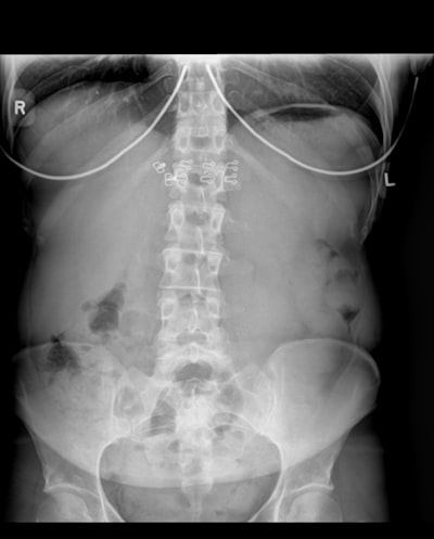 Diagnóstico abdominal seguro y eficiente con deep learning