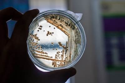 Automatización del metaanálisis de comunidades microbianas para agricultura de precisión