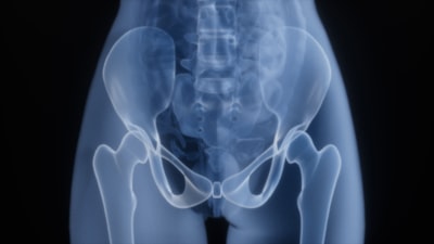 Detección de cambios en tratamiento mediante imágenes de resonancia magnética y radioterapia