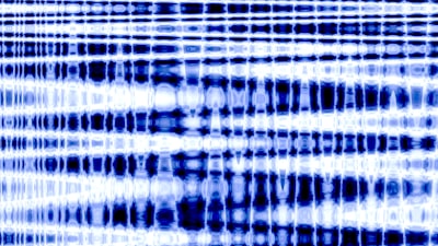 Detección de anomalías con generación de negativos conscientes